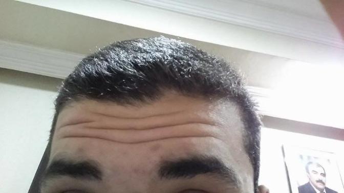 Alnımda ki çizgiler (Yardımcı olabilirmisiniz ) ?