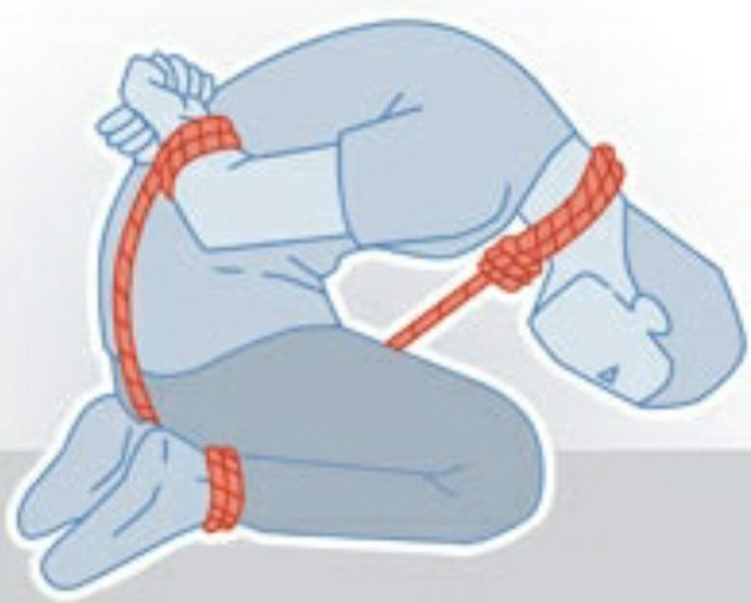 Domuz bağı
