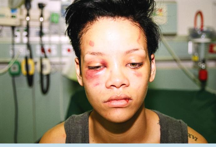Rihanna'nın dayak yediği, Adriana Lima'nın aldatıldığı bu dünyada kendine fazla güvenme hatice. sizcede öyle değil mi ?