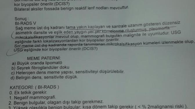 Momografi sonucuma bakabilecek biri?