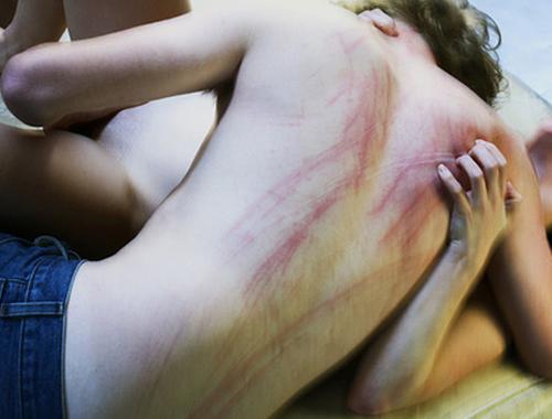 Sabahları neden hormonlar tavan olur?