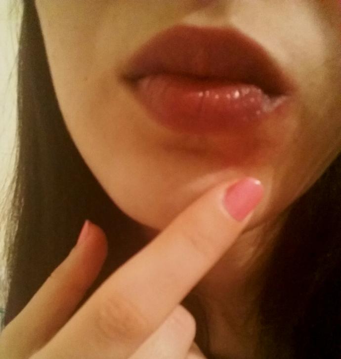 Dudağımdaki doğum lekesi cok mu belli oluyor :/ ?