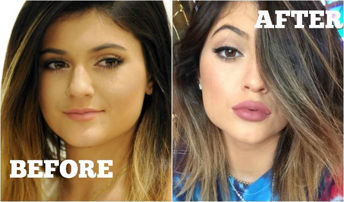 Kylie Jenner (resimli) güzel mi sizce? Dogal güzel olmayana güzel der misiniz?
