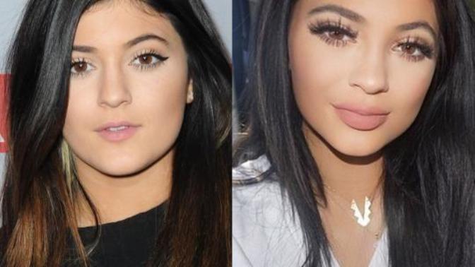 Kylie Jenner (resimli) güzel mi sizce? Dogal güzel olmayana güzel der misiniz?