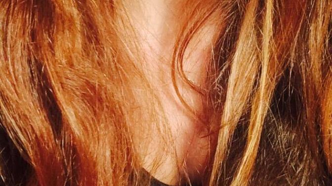 Arkadaşlar sizce diş tellerim ne zaman çıkar (FOTOĞRAFLI) ?
