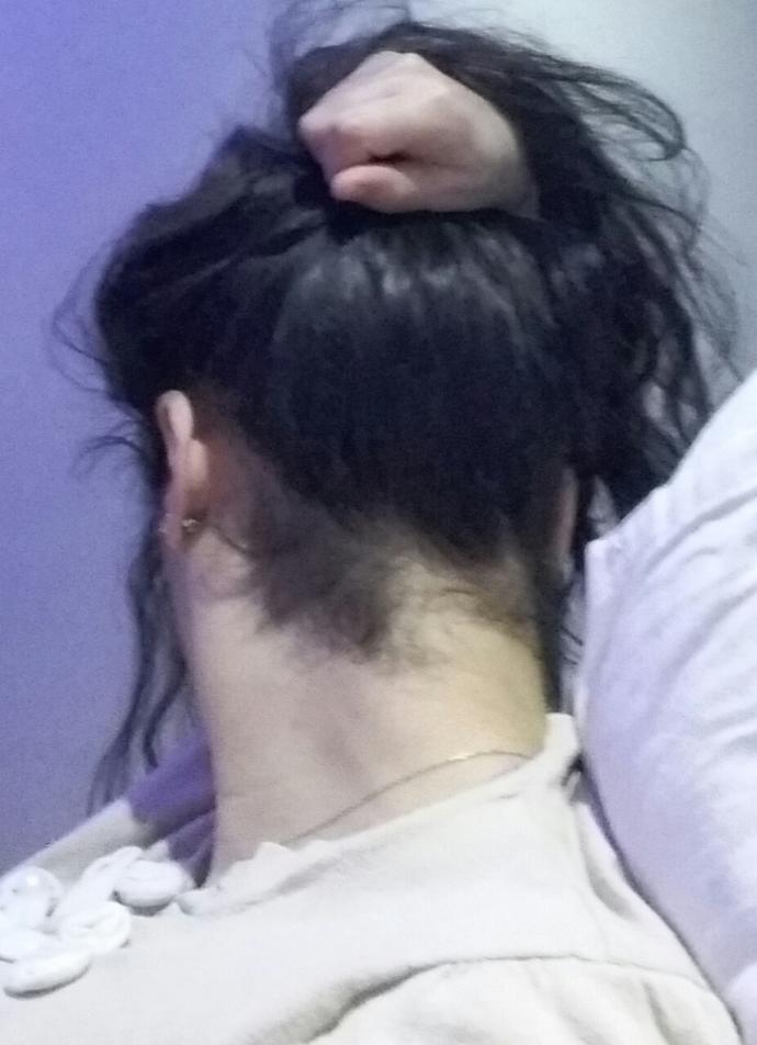 Boyumdaki bu iğrenç kıllardan nasıl kurtulurum :( ? ?
