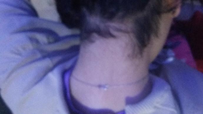 Boyumdaki bu iğrenç kıllardan nasıl kurtulurum :( ? ?