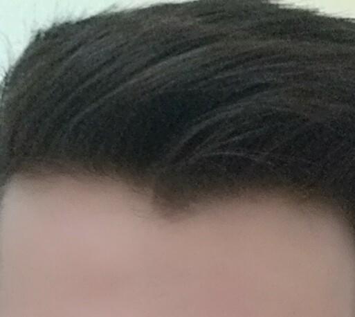 Kelik Belirtisi mi ?