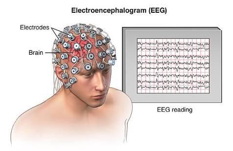 Hiç EEG'ye girdiniz mi?