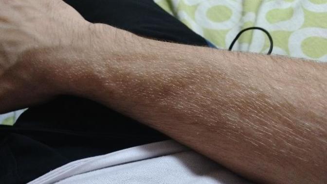 Kollarımdaki Sarı Tüyleri nasıl daha da sarartabilirim (Resimli)?