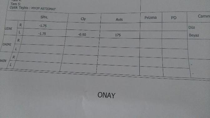 Benim gözlerim kaç derece şimdi (resimli) ?