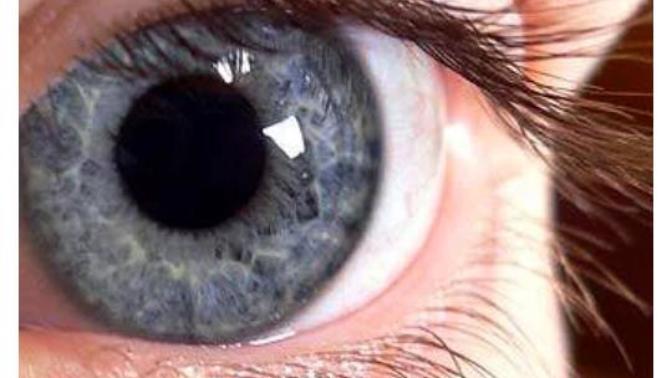 Kusursuz görüş nedir?