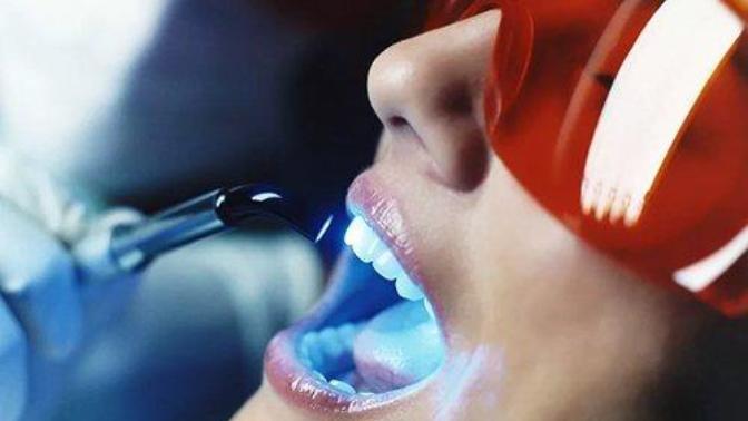 Office bleaching nasıl uygulanıyor?
