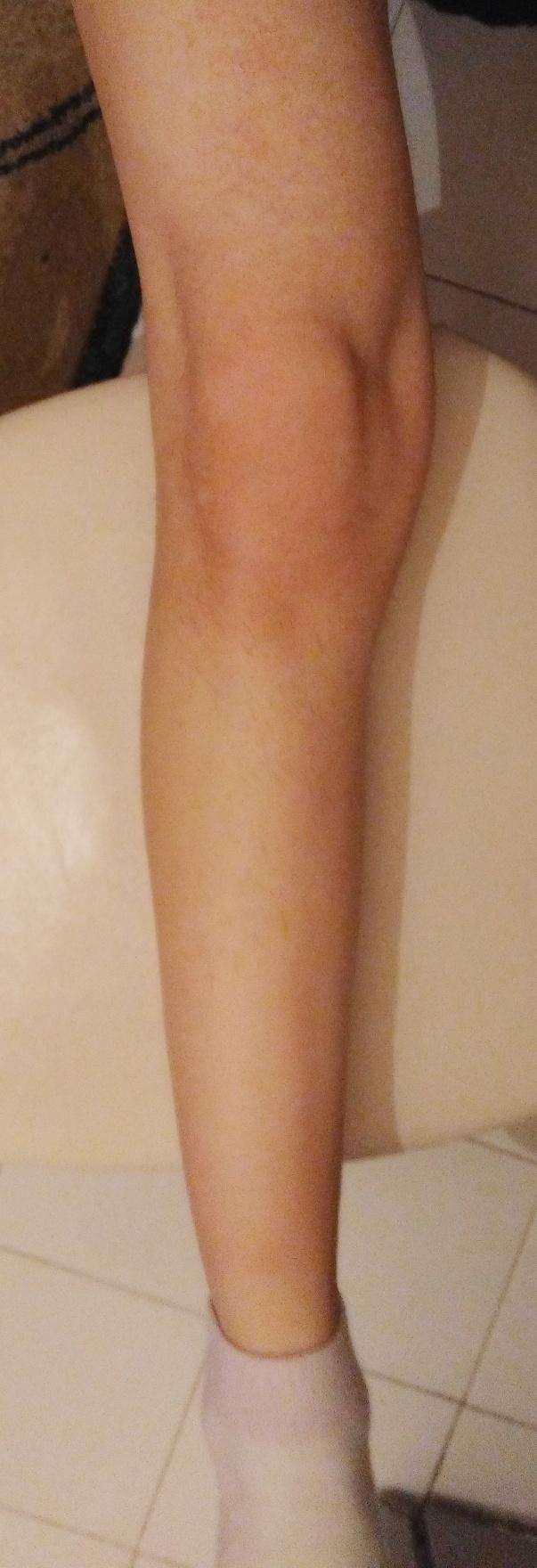 Arkadaşlar bacağım neden böyle?
