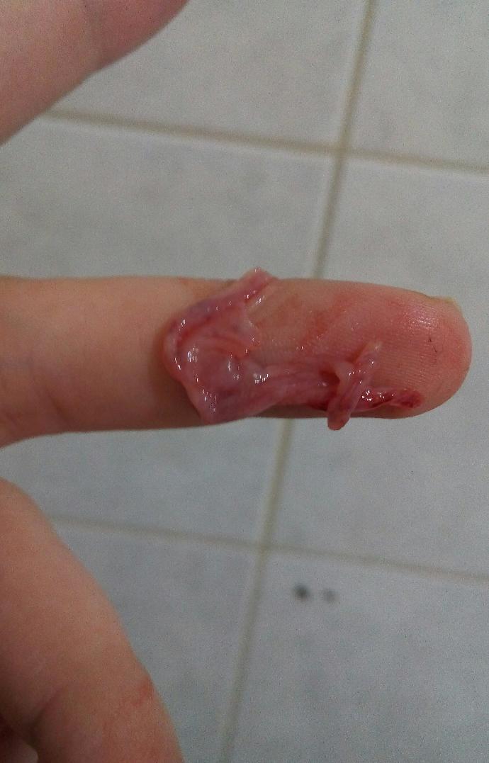 Vajinamdan böyle bir şey geldi ne olabilir?