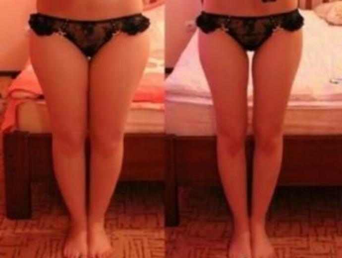 Birbirine değen bacaklar mı yoksa ayrık mı daha seksi?