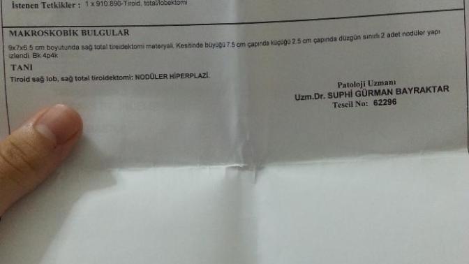 Noduler hiperplazi nedir aramızda illaki doktor  ya da  konuyla ilgili birileri vardır?