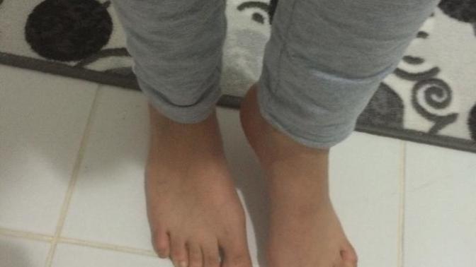 Ayaklarım büyük ve çirkin mi?