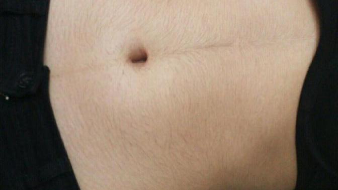 Karnım acayip kıllı lütfen yardım :( resimli) ?