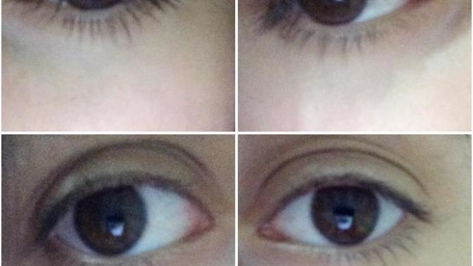 Göz kapaklarım çok mu tuhaf bakın bi' 👀(Fotoğraflı)?
