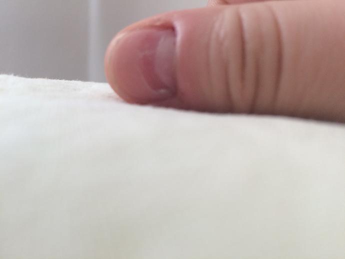 Tırnağımın yarısı soyuldu yardım eder misiniz?