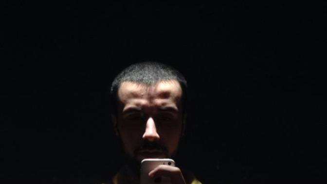 Frontal Alın Kemik Büyümesi bilgisi olan?