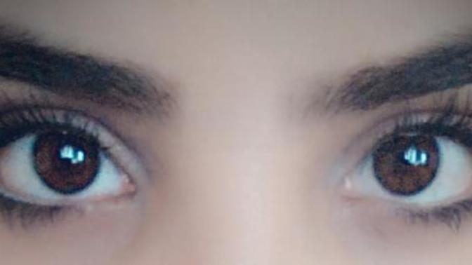 Şaşı mıyım ben yaa :D? (Fotoğraflı)?