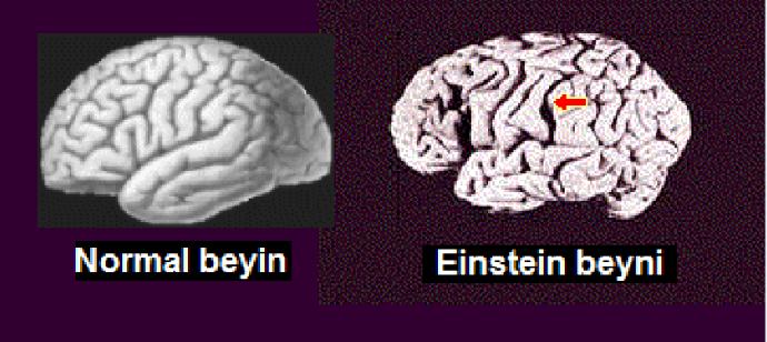 Einstein'ın  beyni hakkında ne düşünüyorsunuz? 