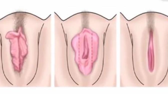 Genital bölge resimleri şekilleri, vajinal bölge görüntüsü