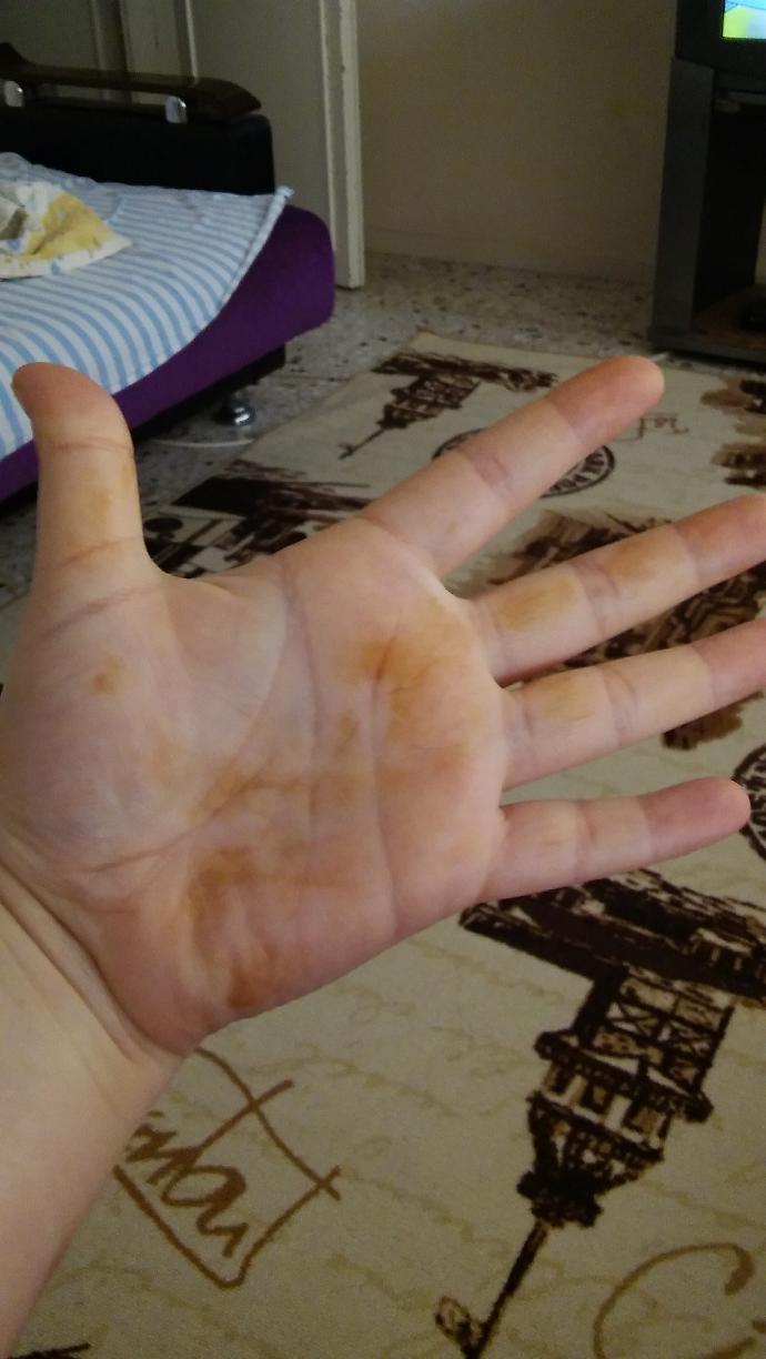 Sabah uyandigimda bununla karsilastim neyin nesi bu?