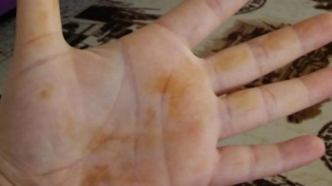 Sabah uyandigimda bununla karsilastim neyin nesi bu?