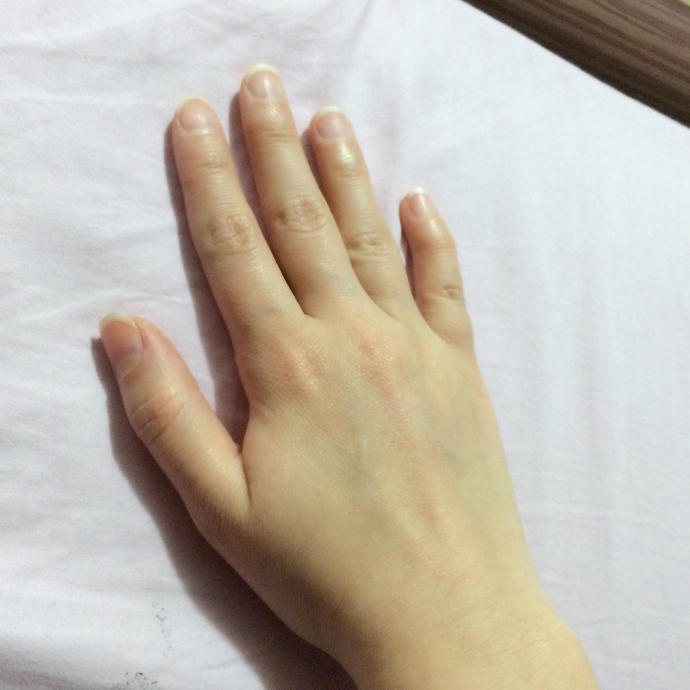 Ellerim nasıl? 22 yaşındayım çok küçük kötü duruyor mu ?