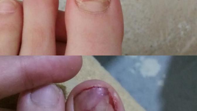 Tırnağım kırıldı nasil temiz tutucam ne yapicam ACİL 😭 Fotoğrafa bakınn?