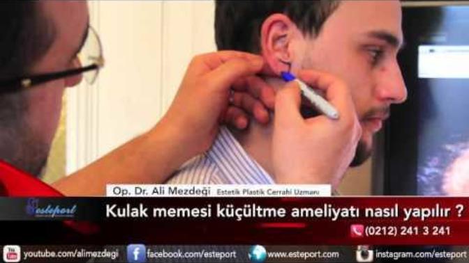 Kulak memesi küçültme ameliyatı nasıl oluyor? Fiyat ya da tavsiye verebilecek olan var mı?