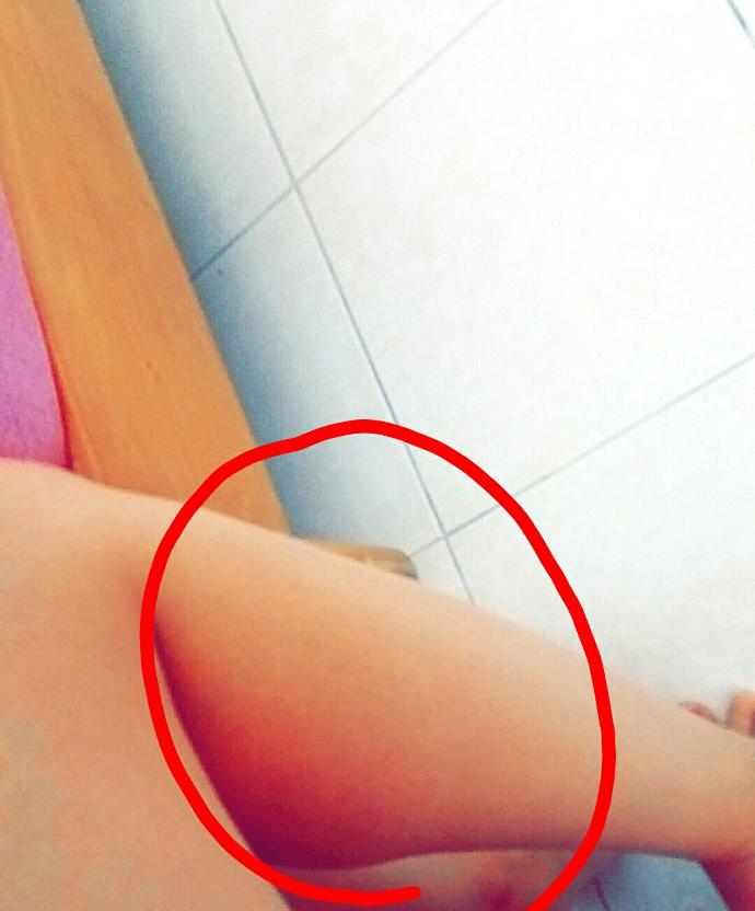 İstemsiz bacak kası?
