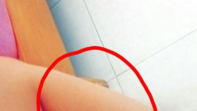 İstemsiz bacak kası?