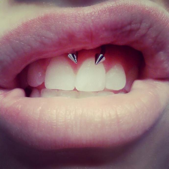 Smiley Piercing Yaptırmak İstiyorum İzmirde Güvenilir Yer Ve Ortalama Fiyat?