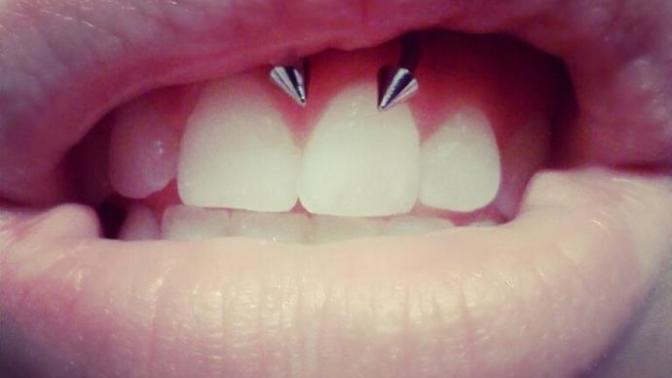 Smiley Piercing Yaptırmak İstiyorum İzmirde Güvenilir Yer Ve Ortalama Fiyat?