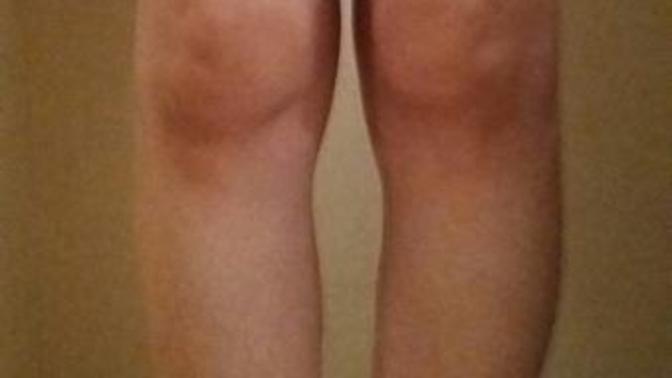 Aranızda ortopedi doktoru varmı?