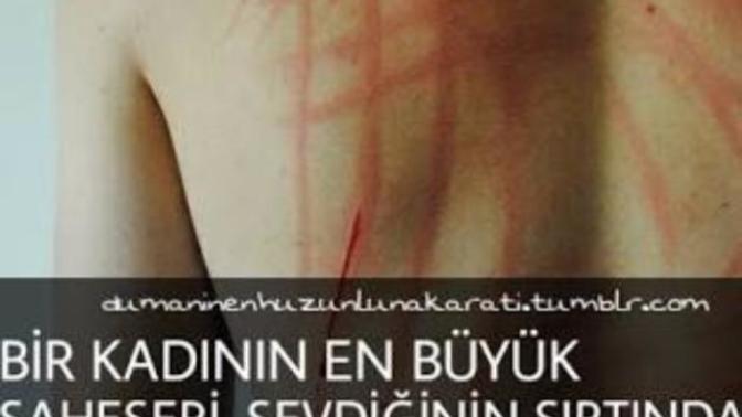 Sabah uyandığınızda vucudunuzda tırnak izlerinin oldugunu görseniz ne yaparsiniz?