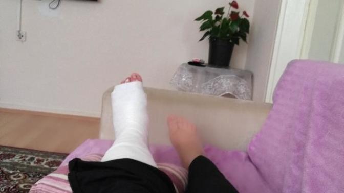 Daha önce kolunuz ya da bacağınız alçıya alındı mı?