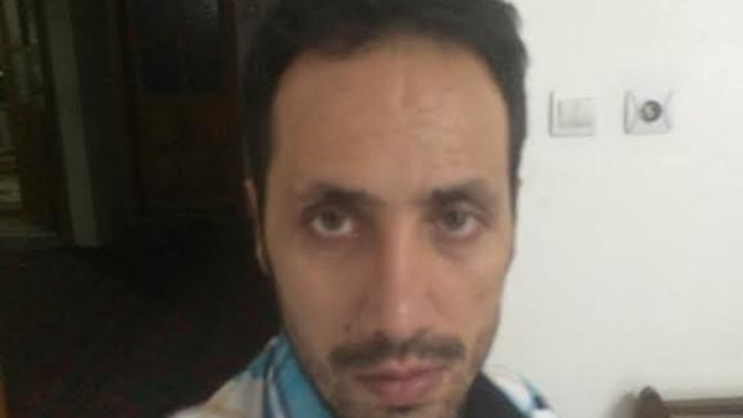 Burun Ameliyatı Sonrası Burunda Yamukluk Var 55. Gün Burun Hala Yamuk?