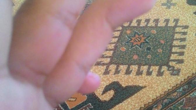 Parmağımı böyle yapabilmem büyük bir problem mi?