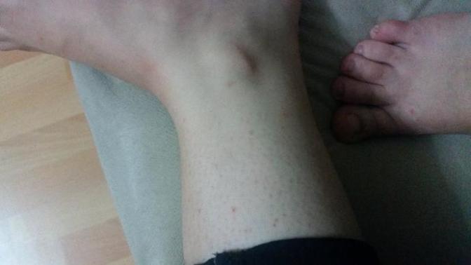 Sally Hansen bacak Fondoteni sizce hangisini almaliydim?