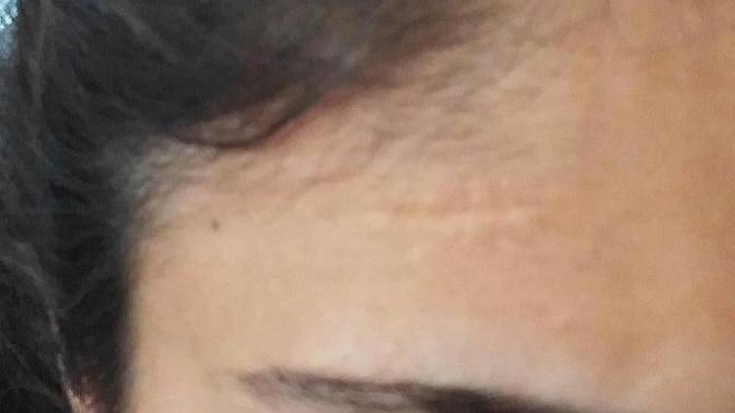 Anlimda dikis izi var polis mulakatinda sorun olur mu?