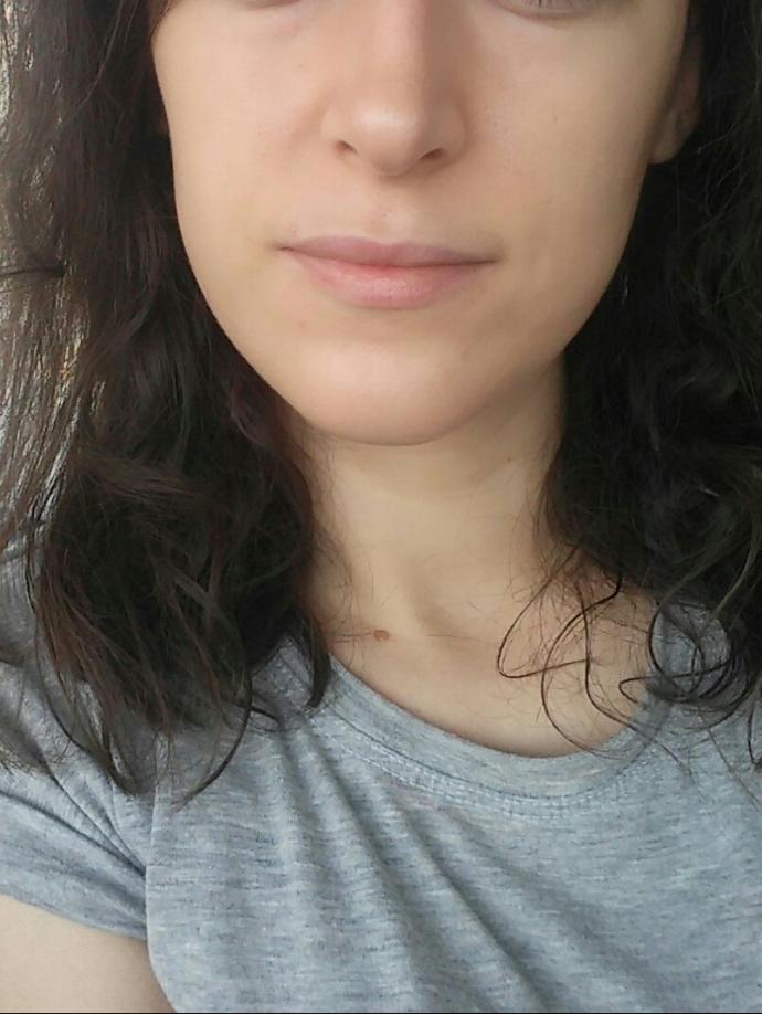Yüzümun yan tarafı neren çökük zayifim diye mi?