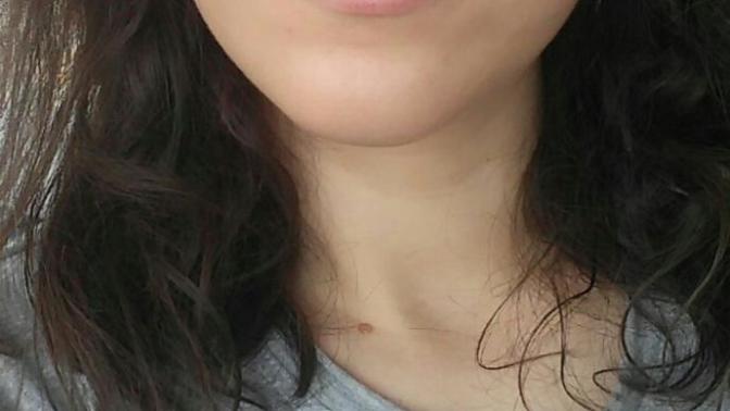 Yüzümun yan tarafı neren çökük zayifim diye mi?