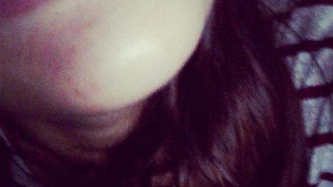 Smiley piercingimi çıkaramıyorum?
