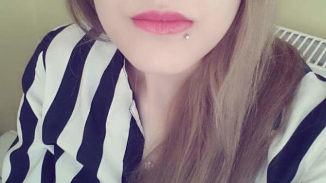 Dudağım çok şişti piercing yüzünden :( (fotolu) ?