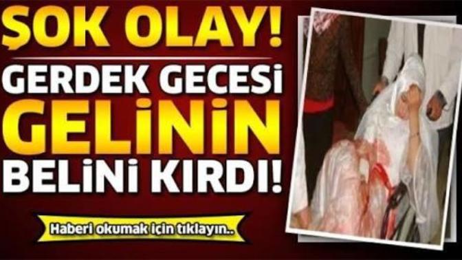 Nasil kiriliyor bu bel?